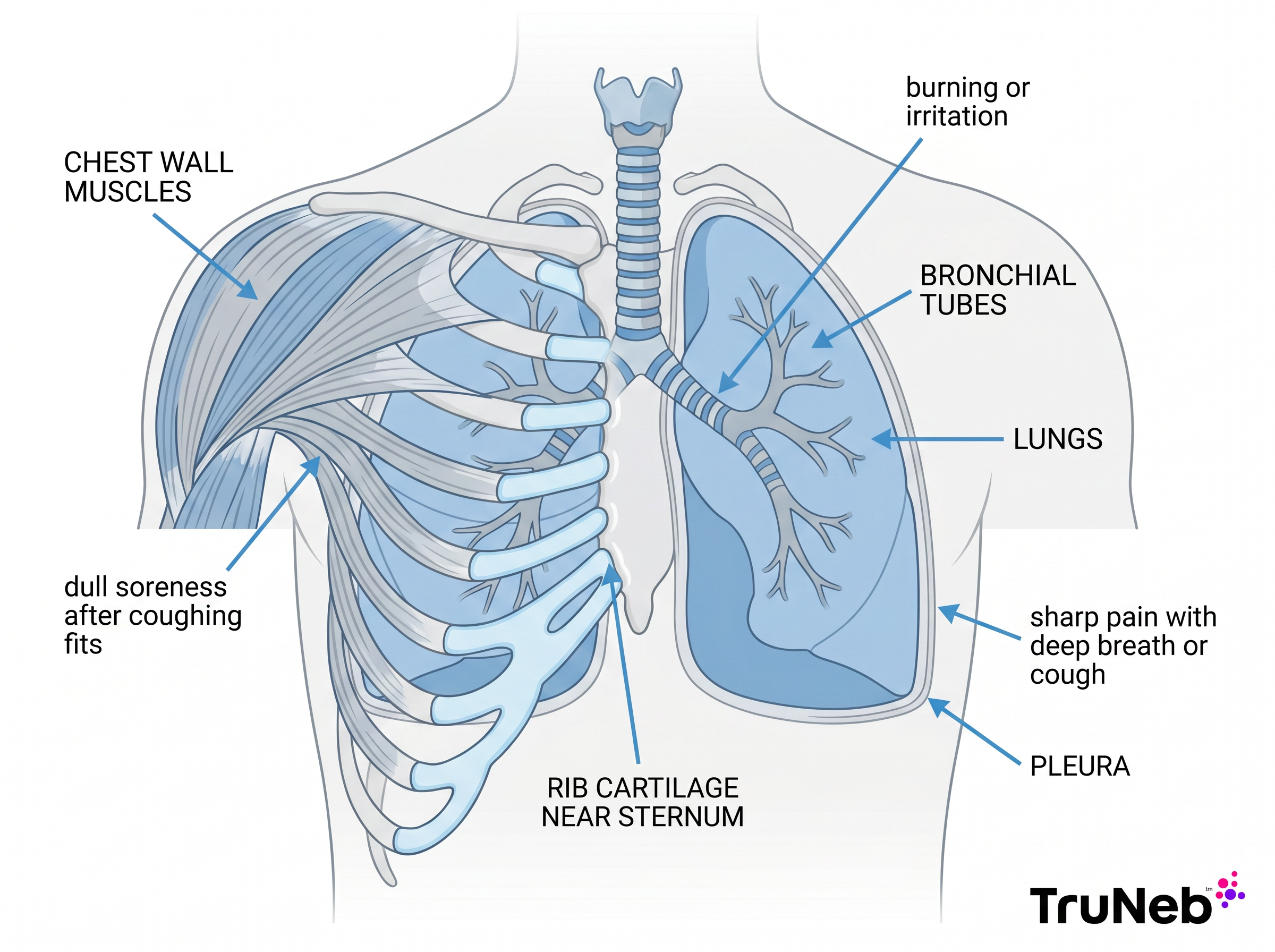 Infographic showing chest wall muscles, rib cartilage, bronchial tubes, pleura, and lungs as possible sources of cough pain