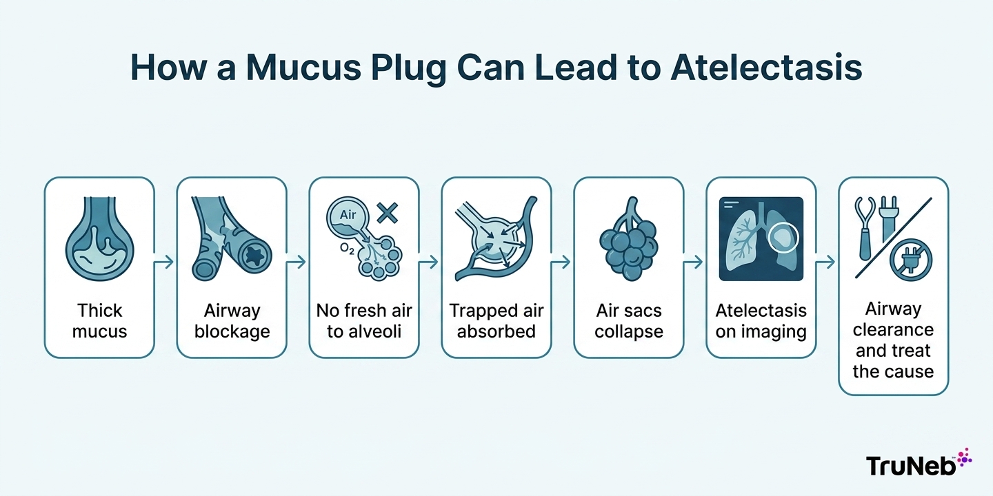 Flowchart showing how a mucus plug can lead to atelectasis