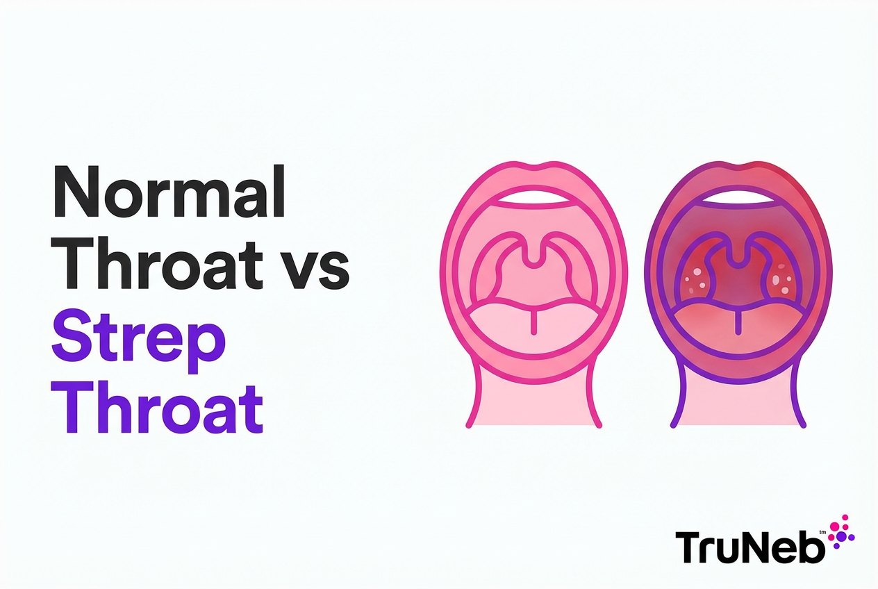 Normal Throat Vs Strep Throat