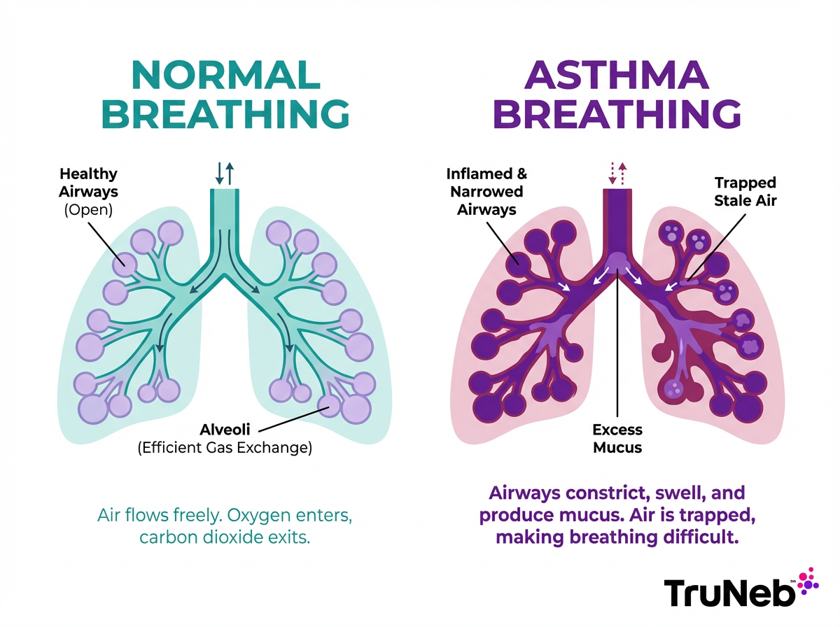 Normal vs. Asthma Breathing (Infographic) Infographic comparing normal breathing and asthma breathing with healthy and narrowed airways