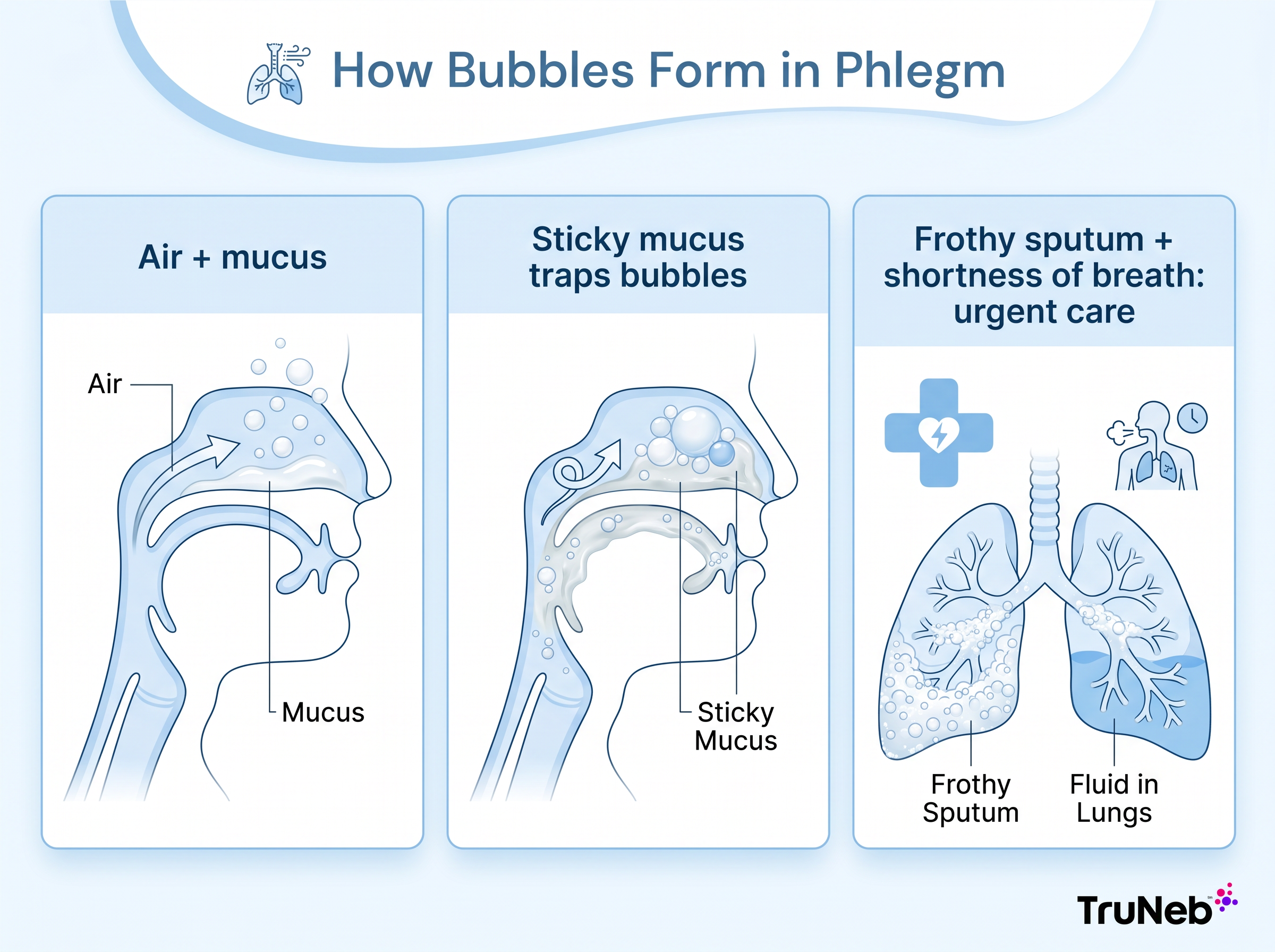 Infographic showing how air mixing with mucus, sticky mucus, and frothy sputum can create bubbles in phlegm